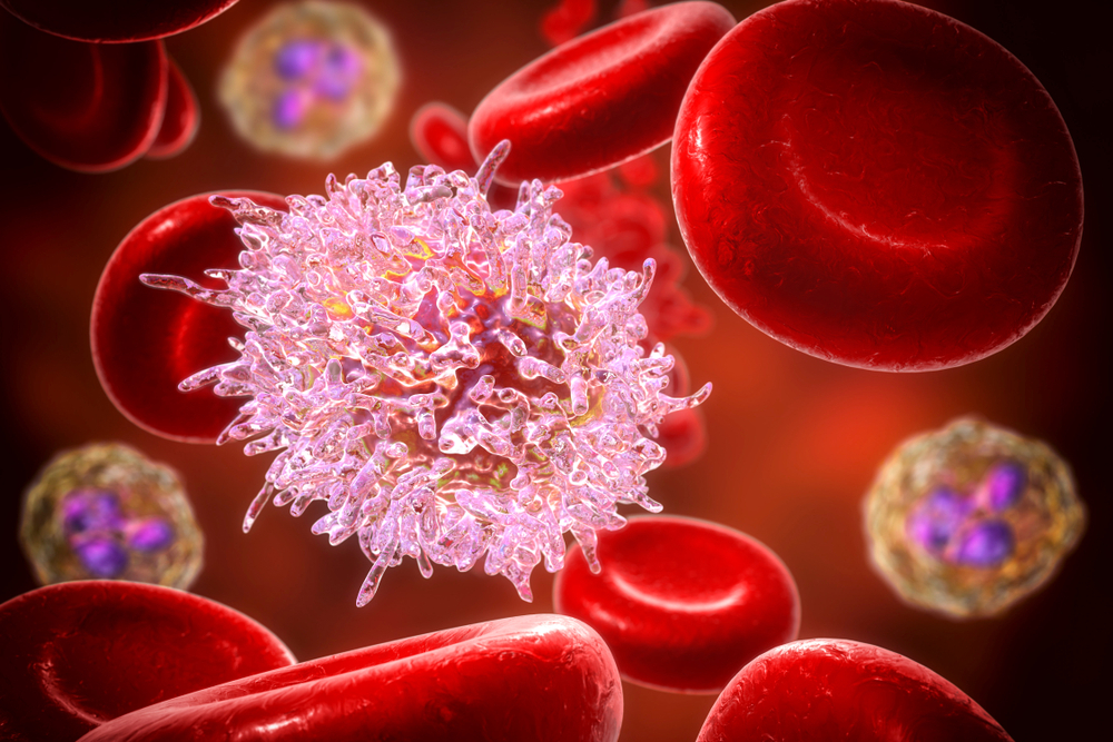 Flavonoides selecionados mostraram resultados promissores como compostos principais para o potencial tratamento da leucemia mieloide aguda