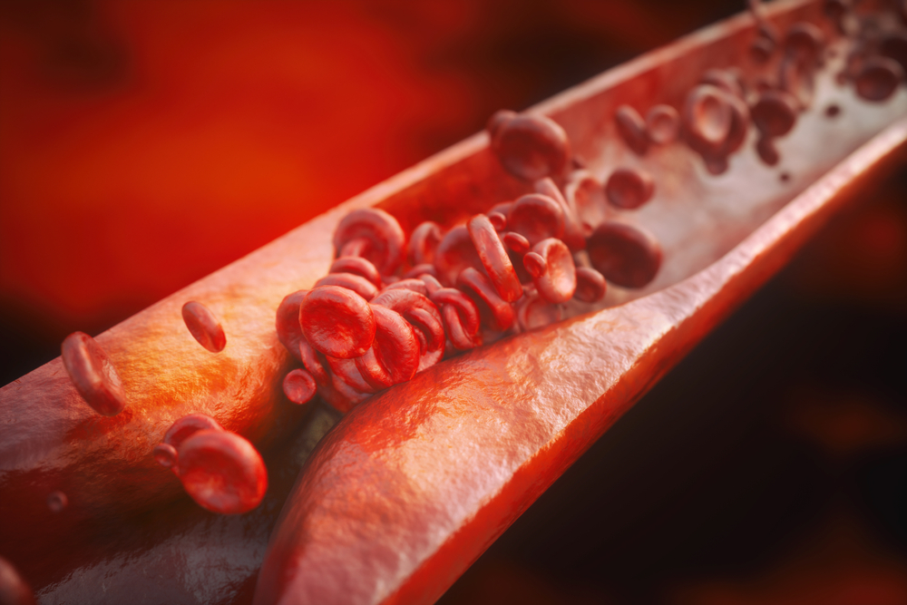 Suplementação de vitamina B12 e vitamina C melhora a reatividade arterial e a estrutura em fumantes passivos